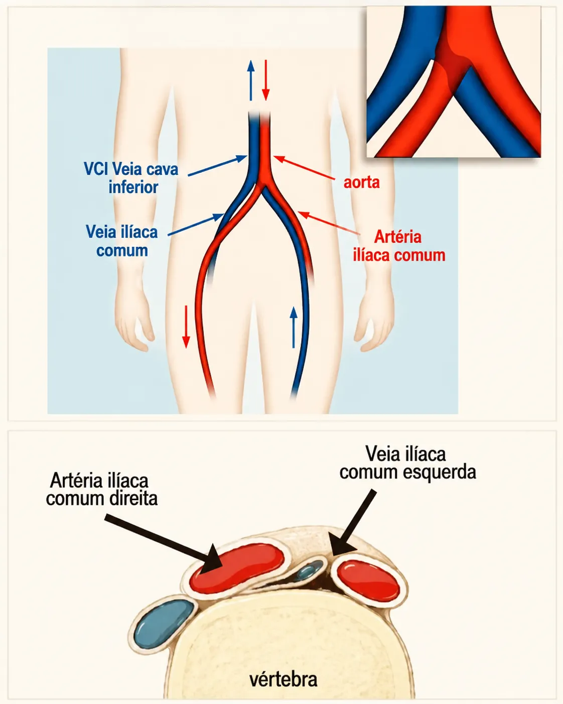 Esquema anatômico da veia cava inferior, veias e artérias ilíacas comuns e corte transversal na altura da vértebra