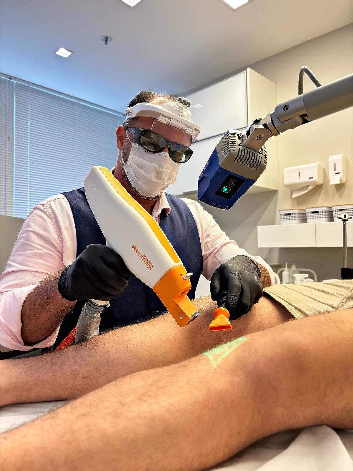 Dr. Stefan Simões aplicando laser transdérmico para tratamento de vasinhos